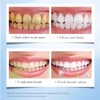 SADOER Peach Toothpaste Tablets – before and after whitening results